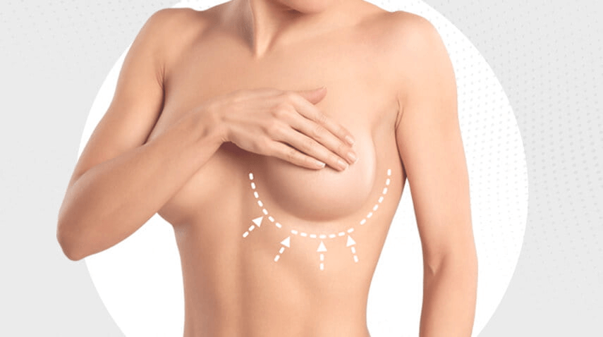 Breast Reduction